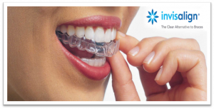 Invisalign - Clinicas Verdi