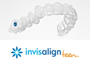 Invisalign ortodoncia invisible - Clínicas Verdi
