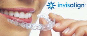 Invisalign ortodoncia invisible - Clínicas Verdi